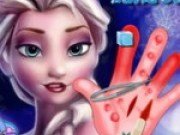 Elsa se opereaza la mana